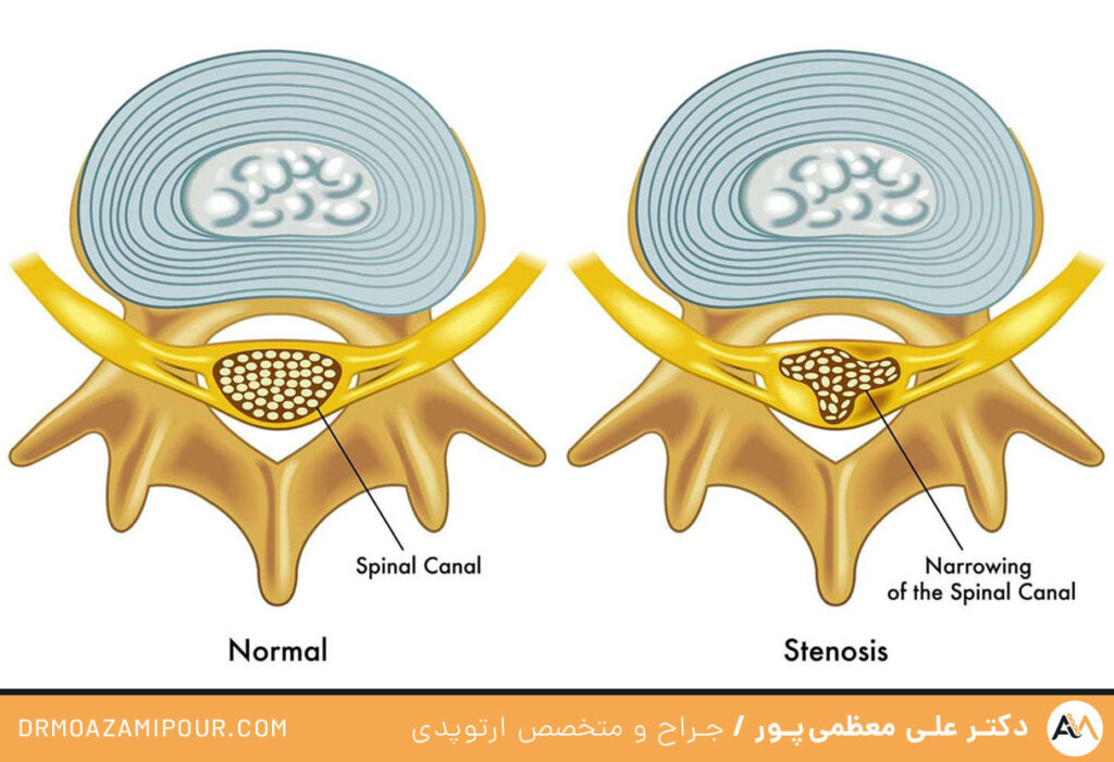 مشکلات ستون فقرات