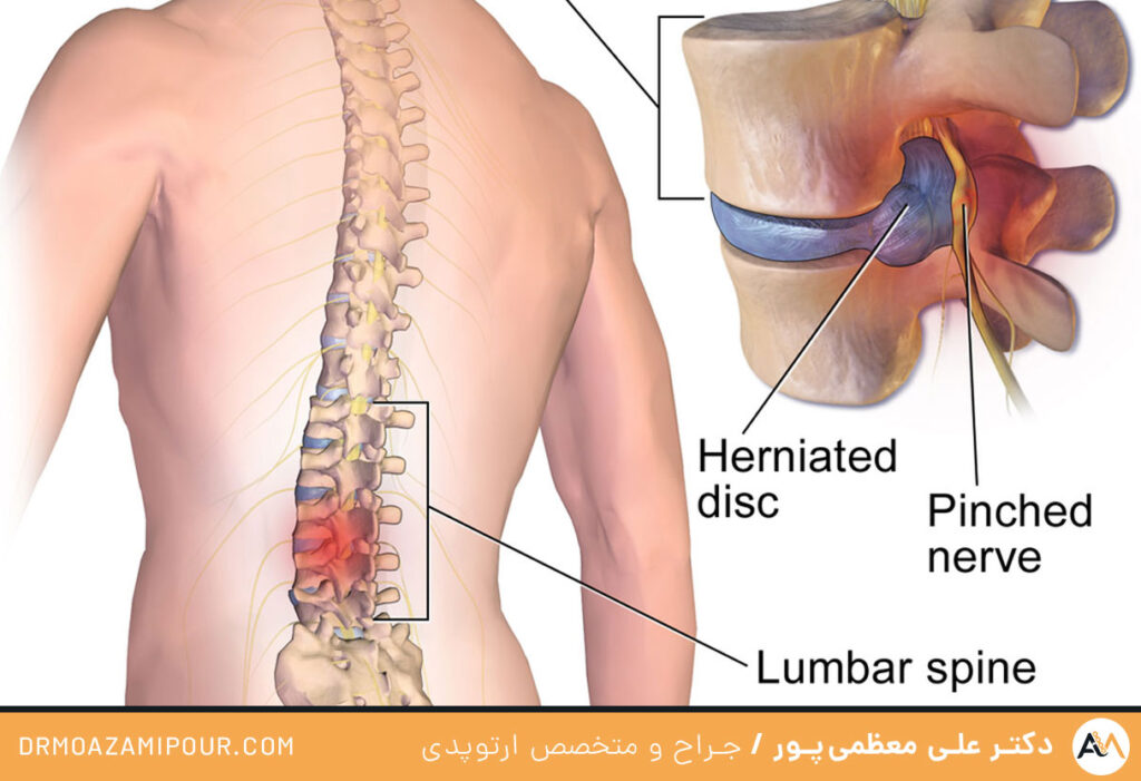 مداخلات جراحی
