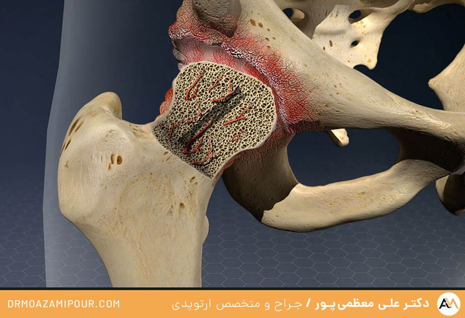 درمان بیماری های مفاصل