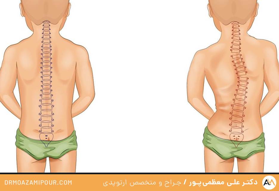 اختلال مادرزادی ارتوپدی