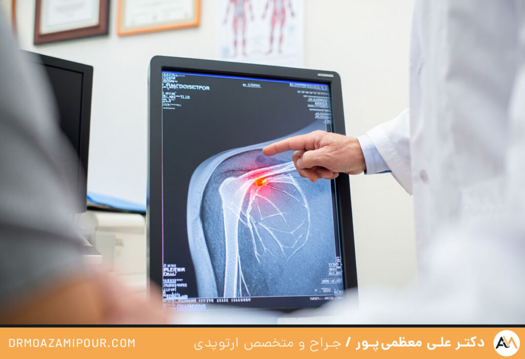 روتاتور کاف شانه