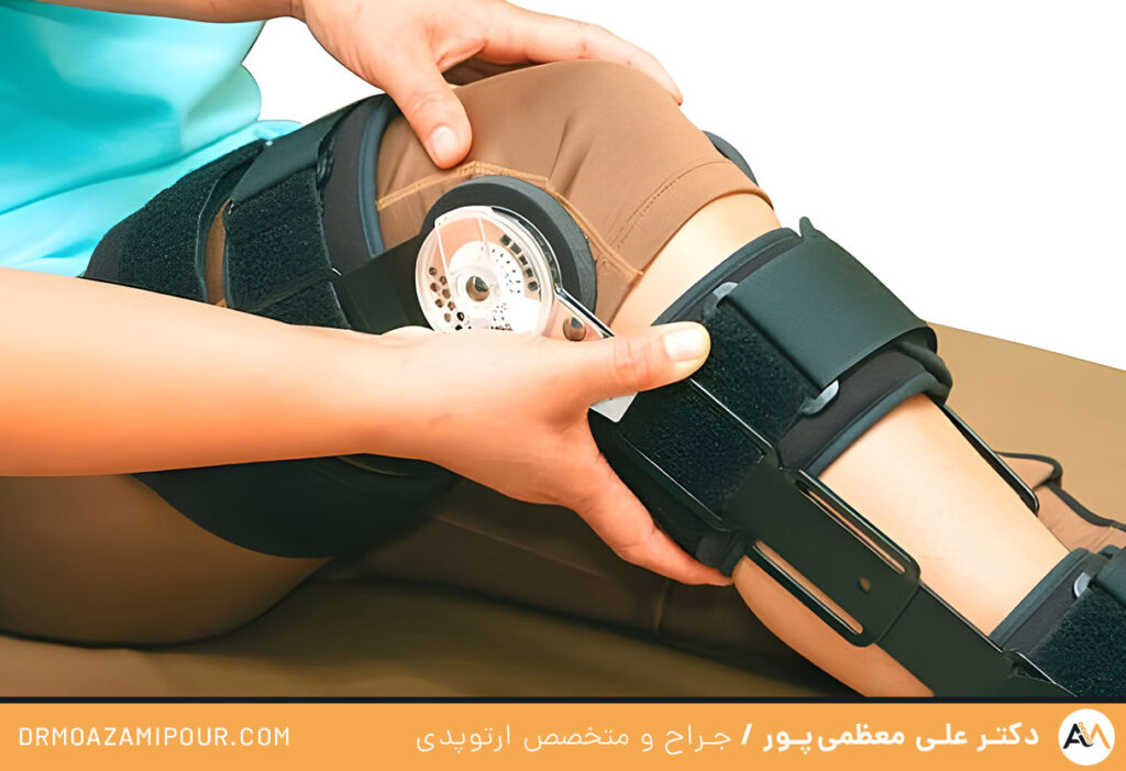  انجام پروتز رباط صلیبی