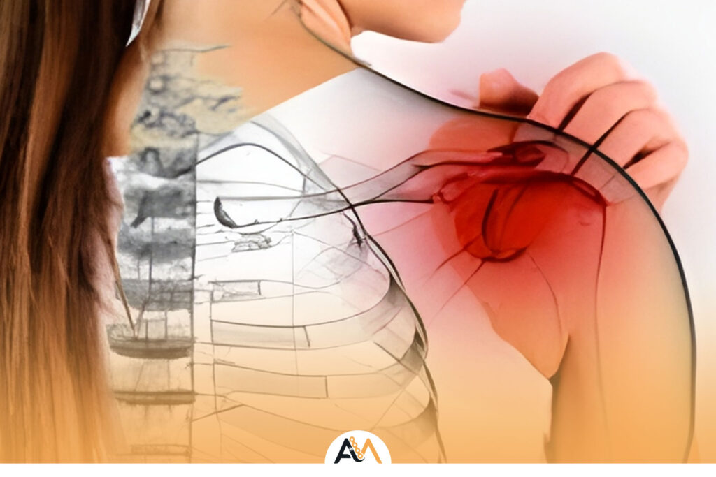 خشکی شانه بعد از عمل