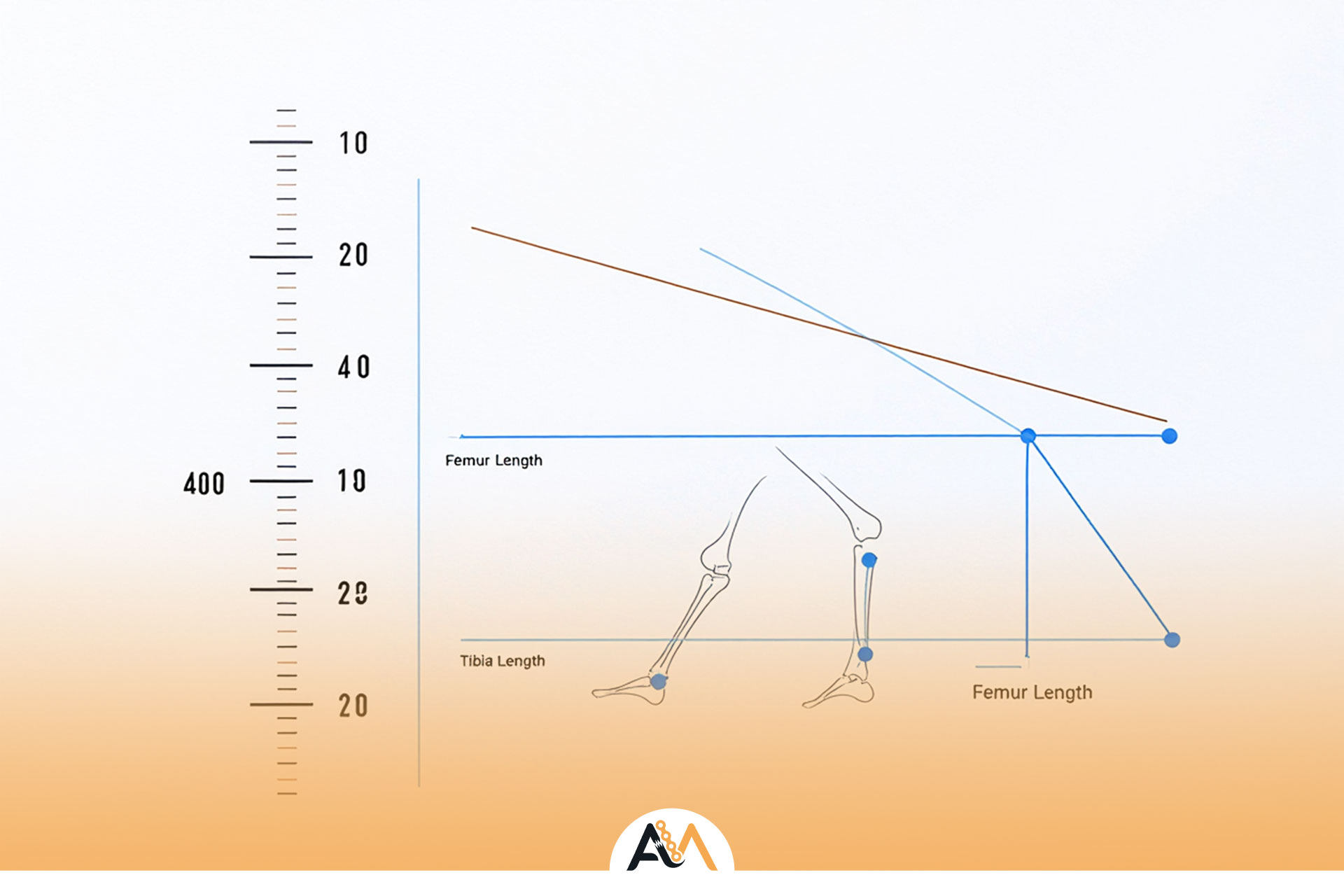 قیمت عمل افزایش قد