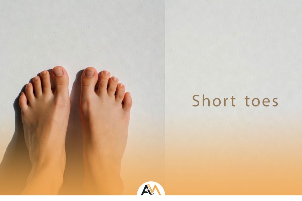 کوتاهی انگشت پا
