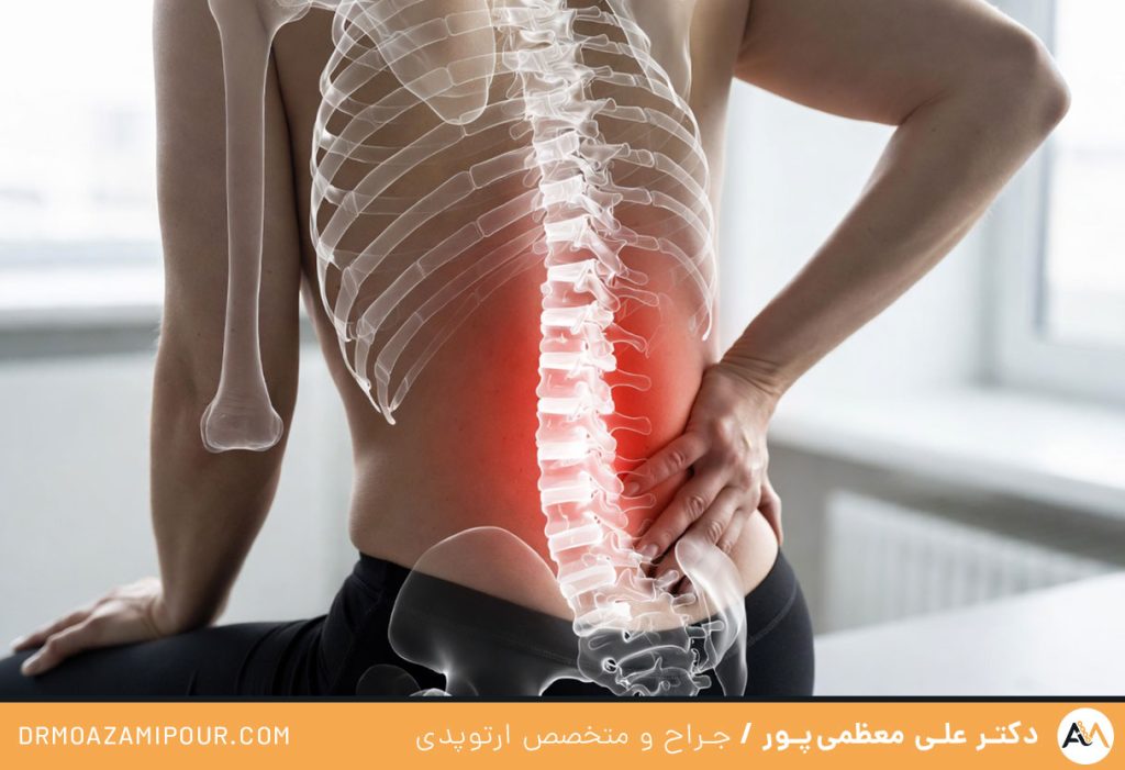 درمان شکستگی استخوان دنبالچه