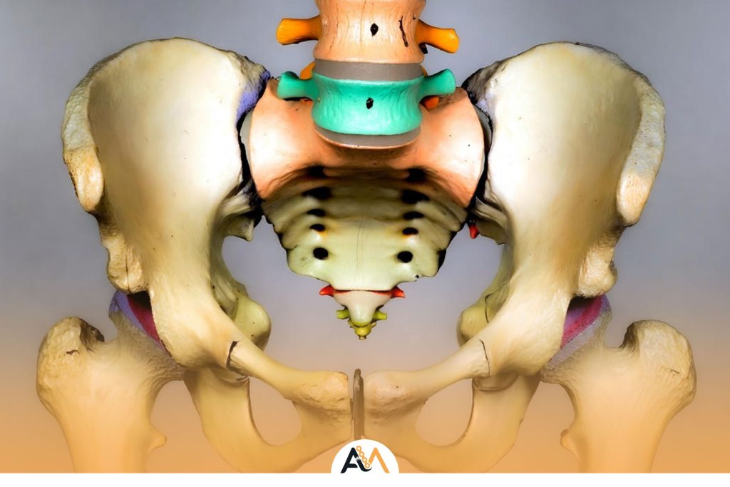 درمان شکستگی لگن