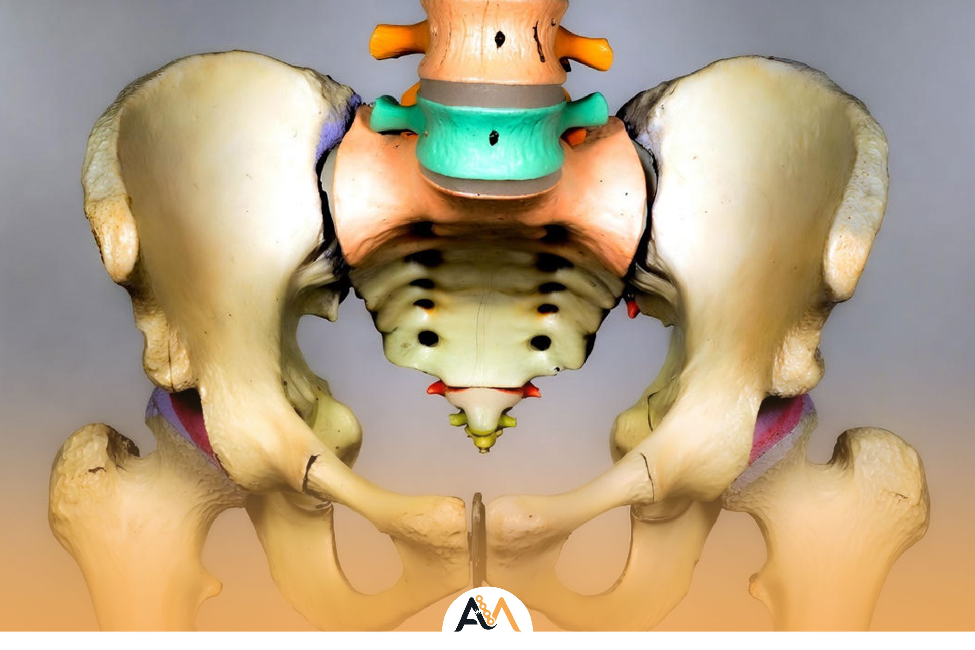 درمان شکستگی لگن