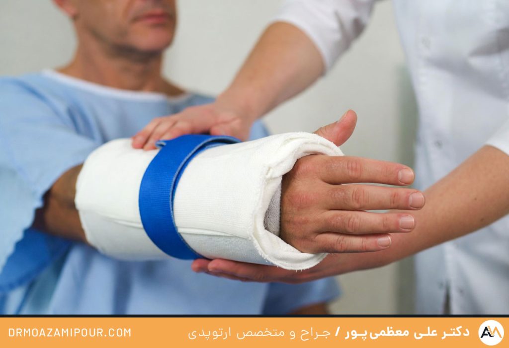 تعویض مفصل آرنج دست