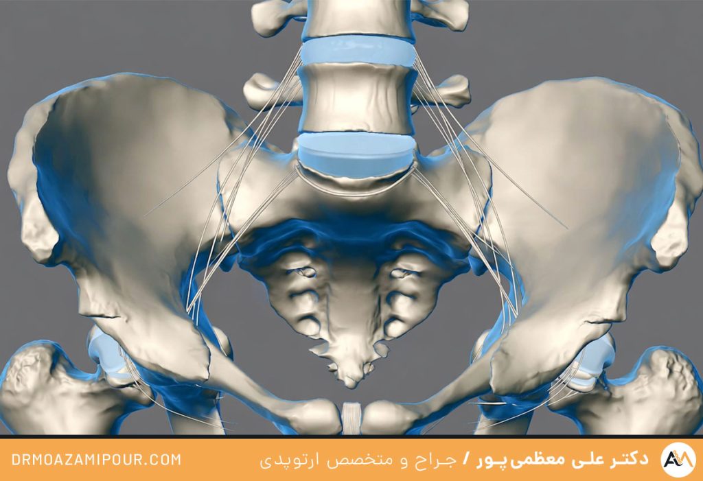  شکستن ساکروم