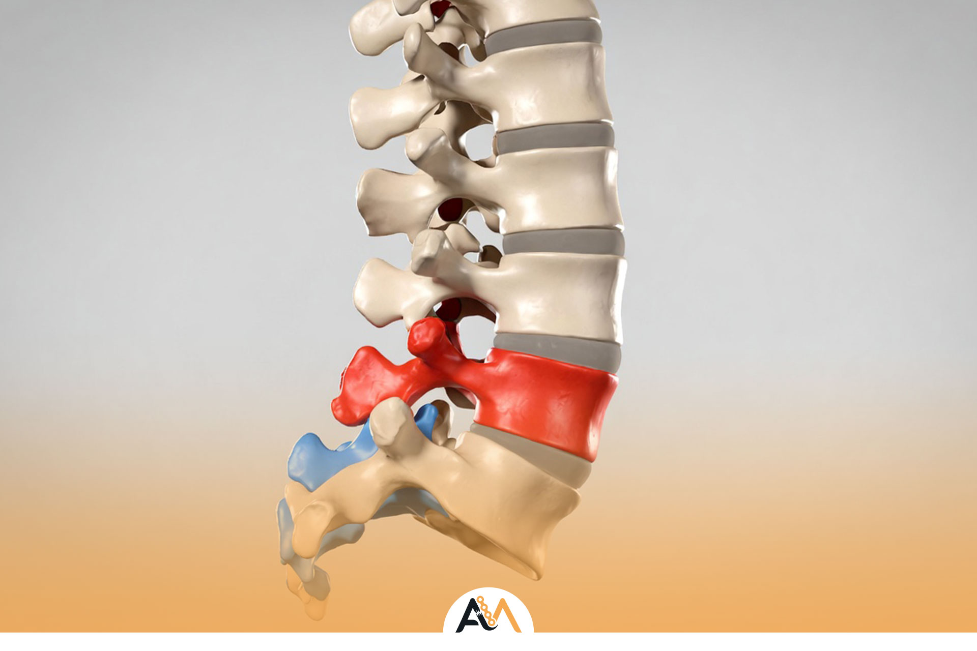 درمان شکستگی ساکروم