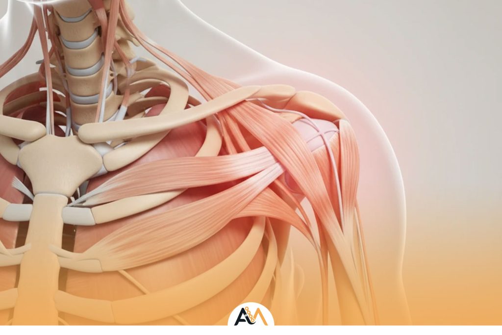 شانه یخ زده