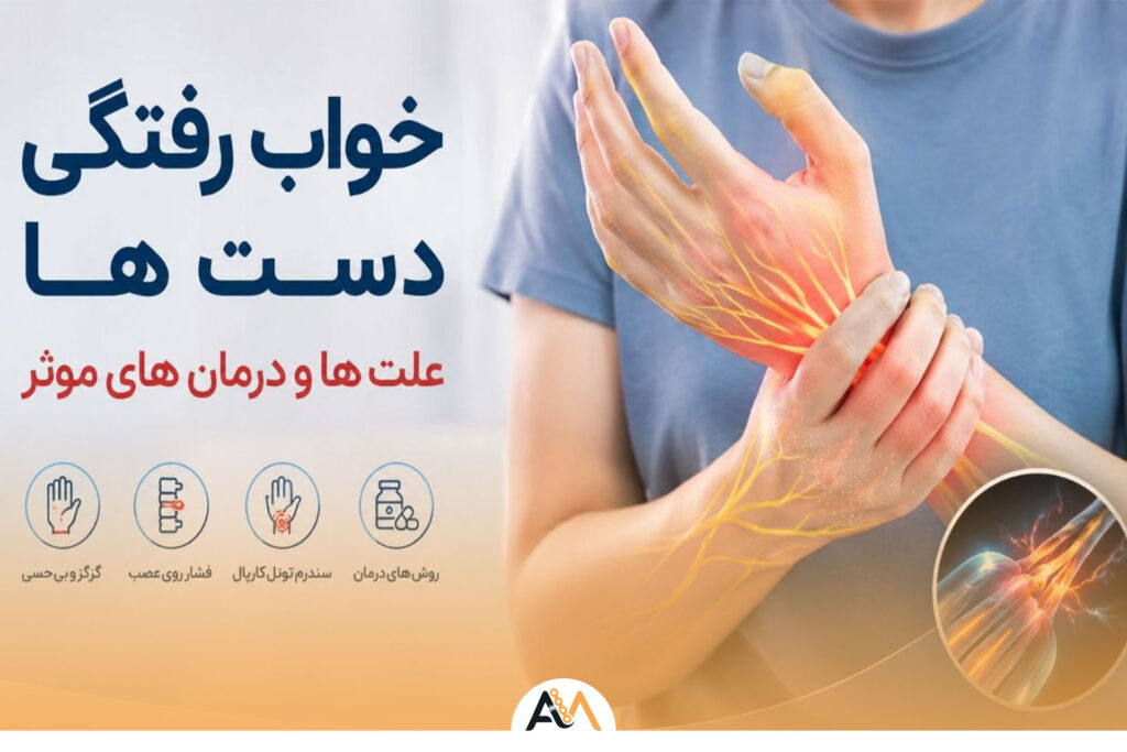 خواب رفتگی دست ها