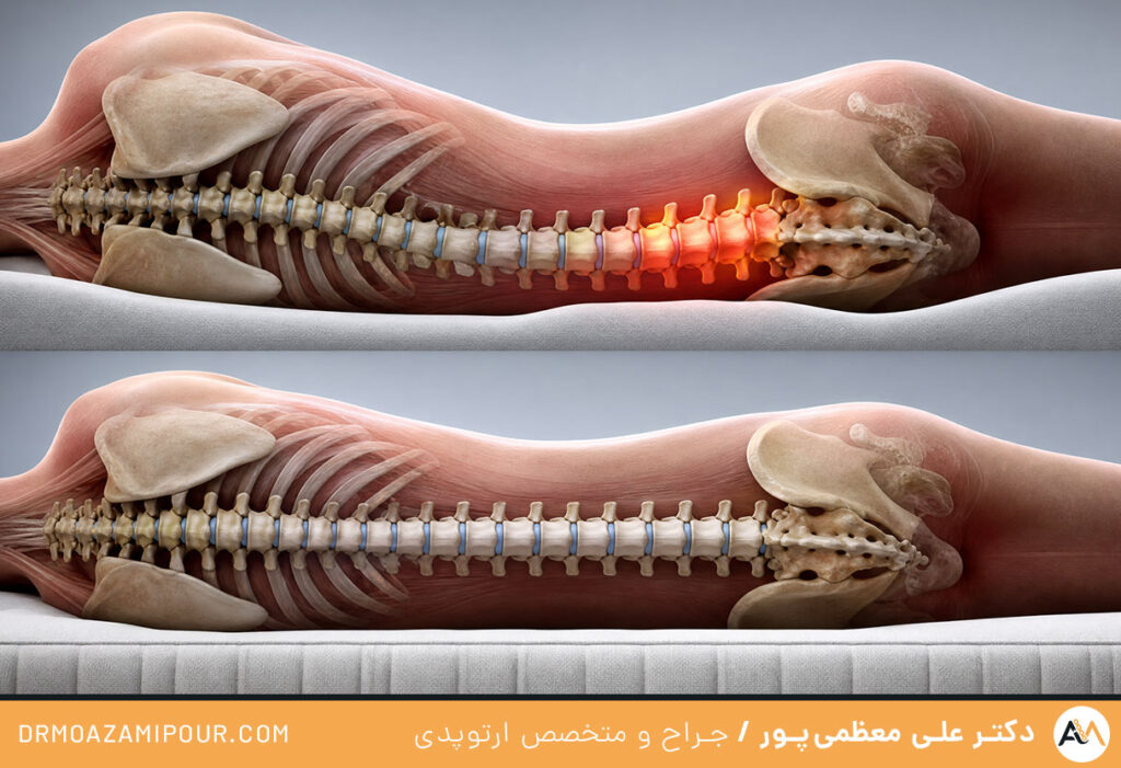 علل کمردرد بعد از خواب