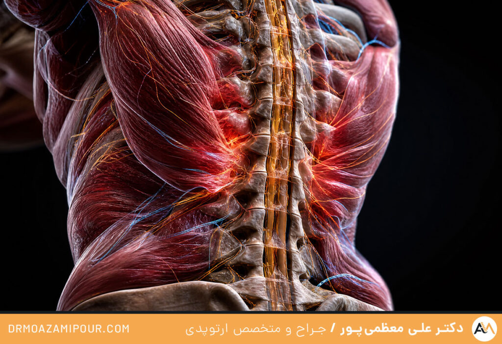 استرس و کمردرد