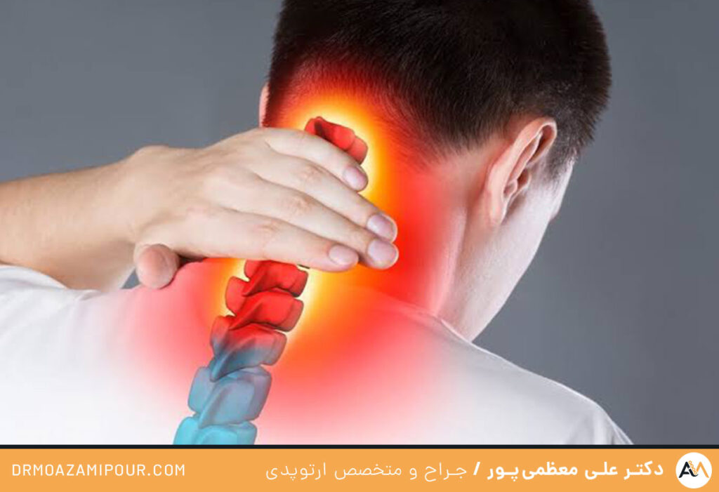  درد گردن بعد از خواب