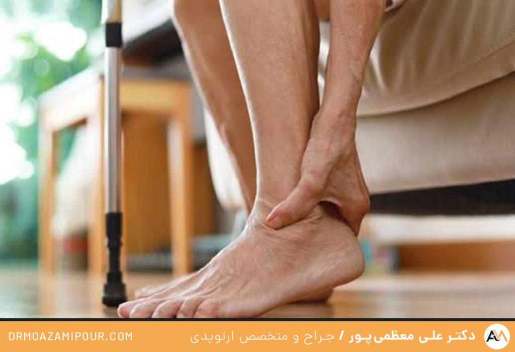درمان کشیدگی مفاصل