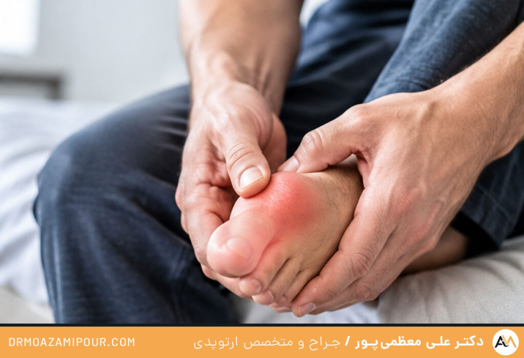 تورم ناگهانی شست پا